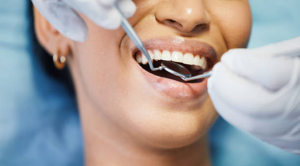 Best Emergency Treatment for Toothache in Towanda, PA