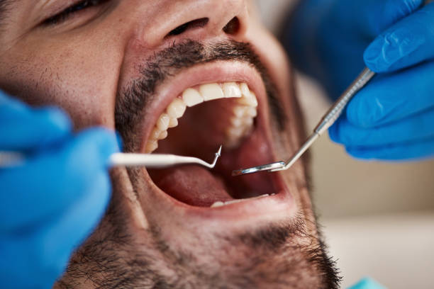 Best After-Hours Emergency Dentist in Towanda, PA