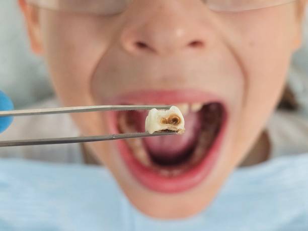 Best Weekend Emergency Dentist in Towanda, PA