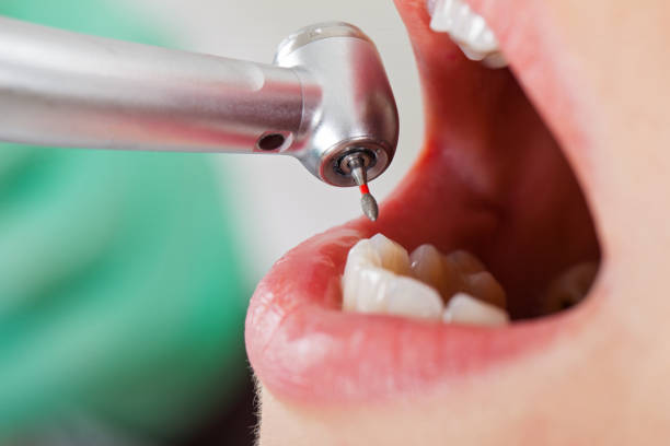 Best Emergency Broken Tooth Repair in Towanda, PA